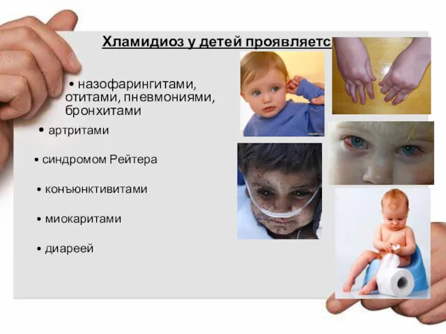 Хламидиоз у детей проявляется: • назофарингитами, отитами, пневмониями, бронхитами •