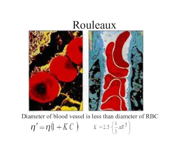 Rouleaux Diameter of blood vessel is less than diameter of RBC