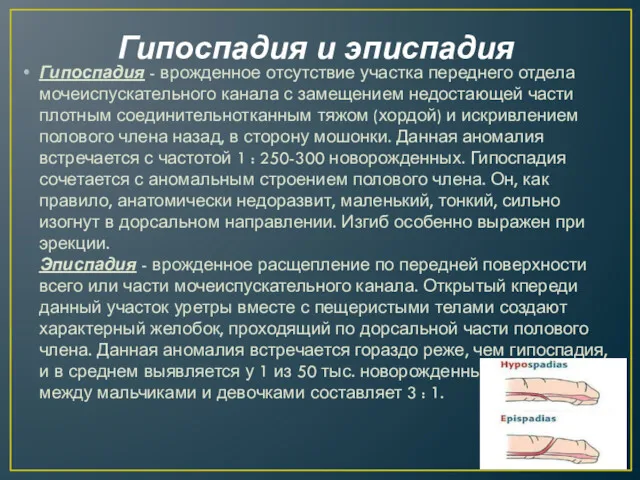 Гипоспадия и эписпадия Гипоспадия - врожденное отсутствие участка переднего отдела