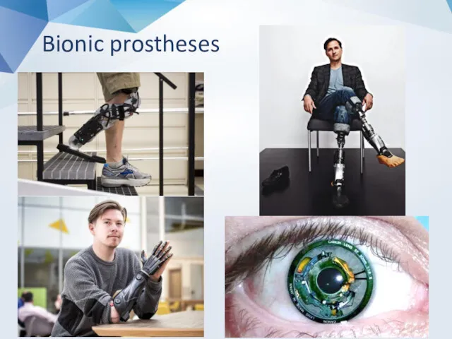 Bionic prostheses