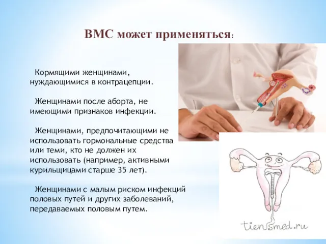 ВМС может применяться: Кормящими женщинами, нуждающимися в контрацепции. Женщинами после