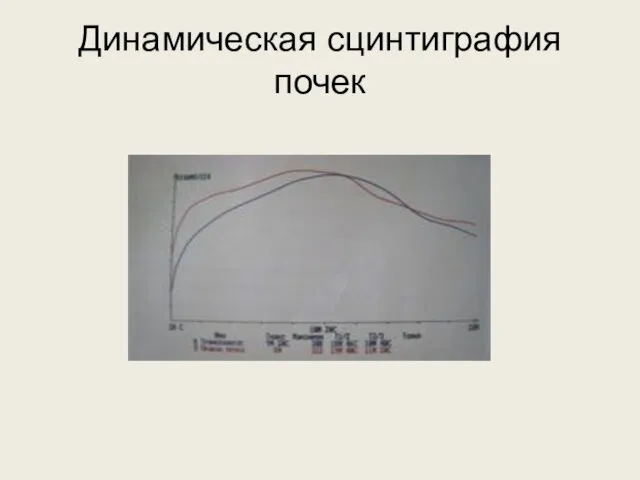 Динамическая сцинтиграфия почек