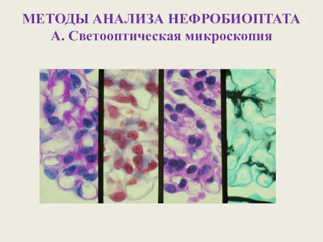 МЕТОДЫ АНАЛИЗА НЕФРОБИОПТАТА А. Светооптическая микроскопия