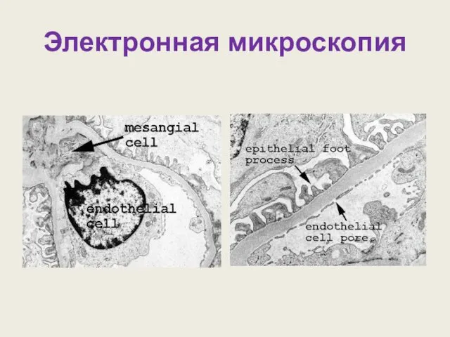 Электронная микроскопия