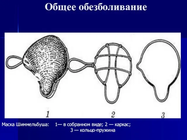 Общее обезболивание Маска Шиммельбуша: 1— в собранном виде; 2 — каркас; 3 — кольцо-пружина