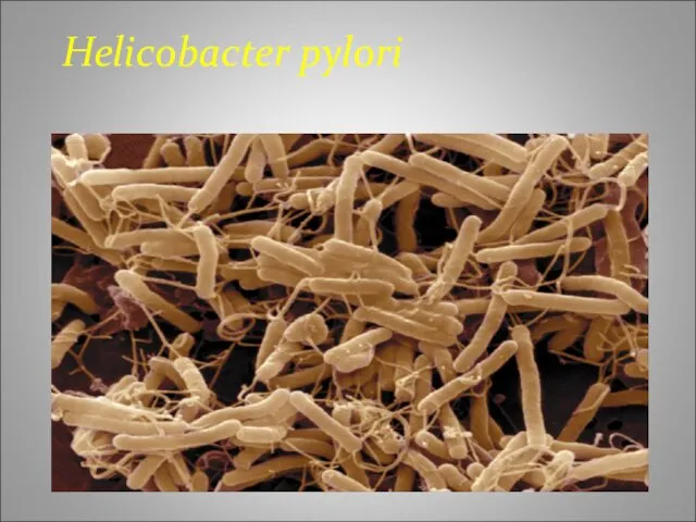 Helicobacter pylori