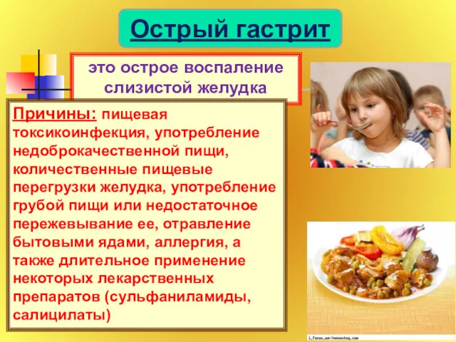 Острый гастрит это острое воспаление слизистой желудка Причины: пищевая токсикоинфекция,