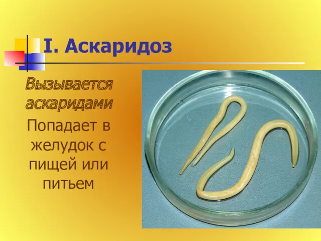 I. Аскаридоз Вызывается аскаридами Попадает в желудок с пищей или питьем