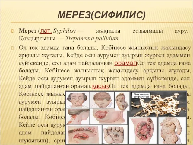 МЕРЕЗ(СИФИЛИС) Мерез (лат. Syphilis) — жұқпалы созылмалы ауру. Қоздырғышы — Treponema pallidum. Ол
