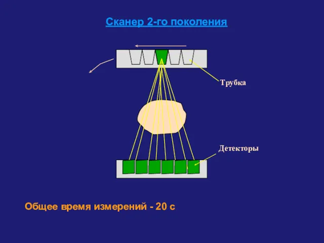 Трубка Детекторы Сканер 2-го поколения Общее время измерений - 20 с