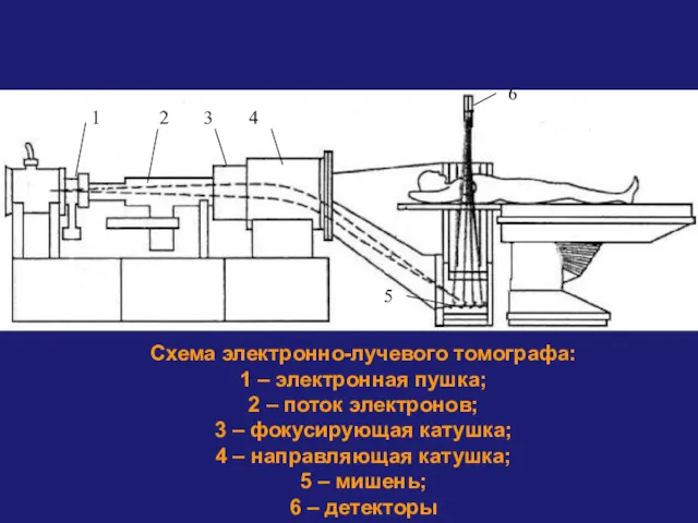 Схема электронно-лучевого томографа: 1 – электронная пушка; 2 – поток