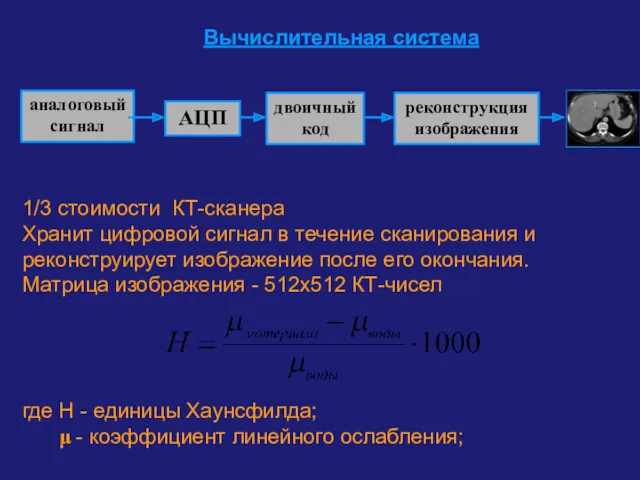 Вычислительная система 1/3 стоимости КТ-сканера Хранит цифровой сигнал в течение