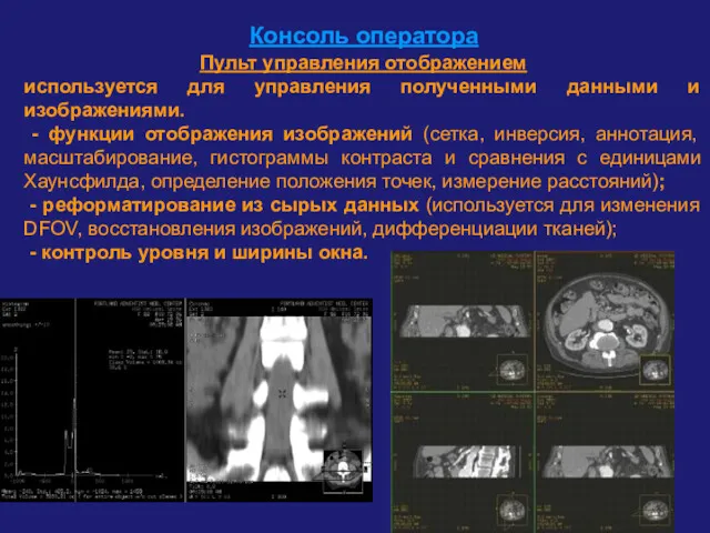 Консоль оператора Пульт управления отображением используется для управления полученными данными