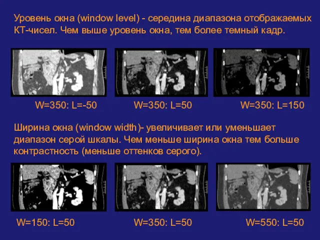 Уровень окна (window level) - середина диапазона отображаемых КТ-чисел. Чем