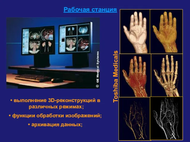 Рабочая станция выполнение 3D-реконструкций в различных режимах; функции обработки изображений; архивация данных; Toshiba Medicals