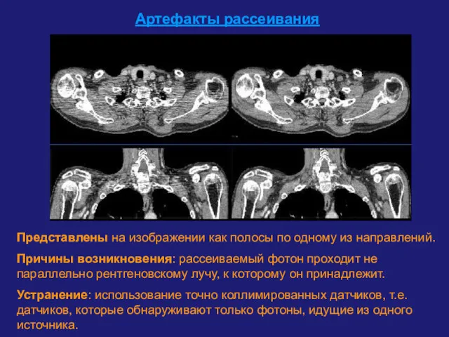 Артефакты рассеивания Представлены на изображении как полосы по одному из