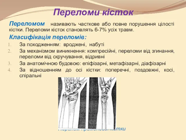 Переломи кісток Переломом називають часткове або повне порушення цілості кістки.