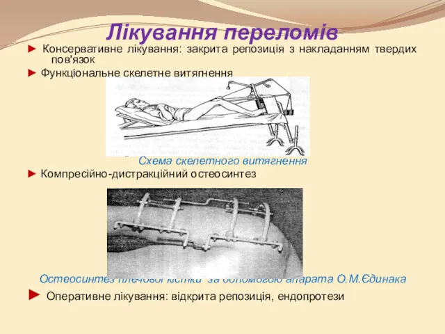 Лікування переломів ► Консервативне лікування: закрита репозиція з накладанням твердих