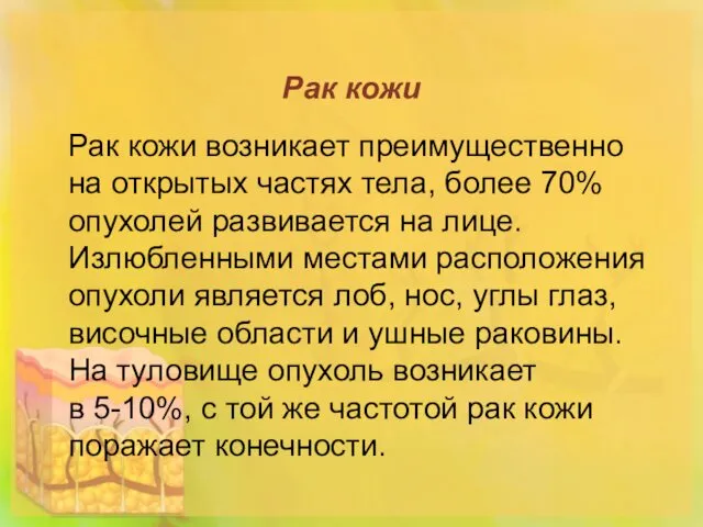 Рак кожи Рак кожи возникает преимущественно на открытых частях тела,