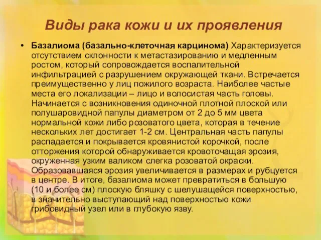 Виды рака кожи и их проявления Базалиома (базально-клеточная карцинома) Характеризуется