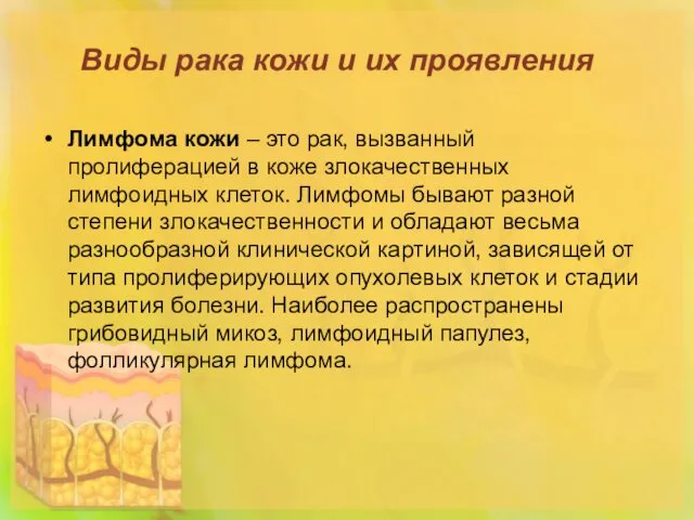 Виды рака кожи и их проявления Лимфома кожи – это