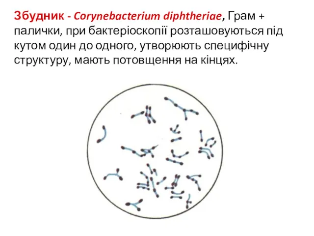 Збудник - Corynebacterium diphtheriae, Грам + палички, при бактеріоскопії розташовуються