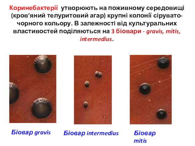 Біовар intermedius Біовар gravis Біовар mitis Коринебактерії утворюють на поживному