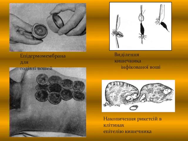 Епідермомембрана для годівлі вошей Виділення кишечника інфікованої воші Накопичення рикетсій в клітинах епітелію кишечника