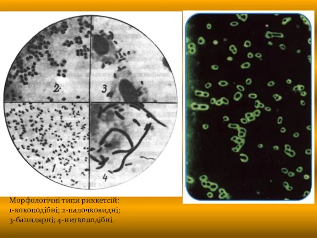 Морфологічні типи риккетсій: 1-кокоподібні; 2-палочковидні; 3-бацилярні; 4-ниткоподібні.
