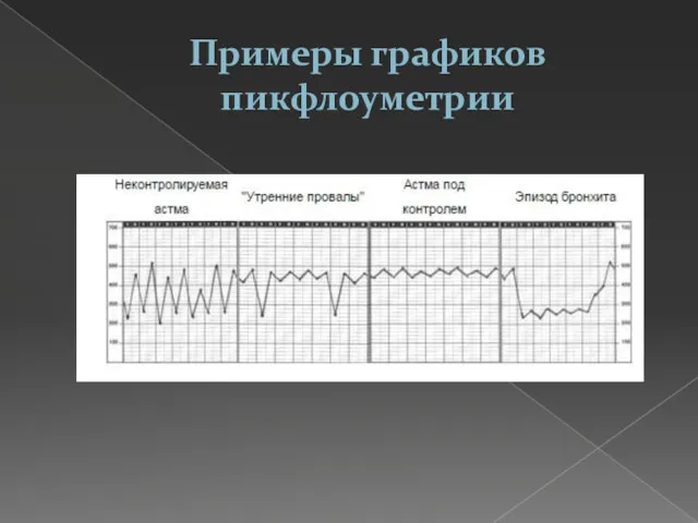 Примеры графиков пикфлоуметрии