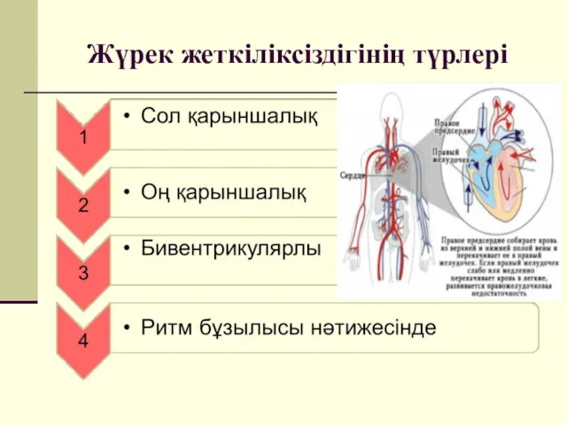 Жүрек жеткіліксіздігінің түрлері