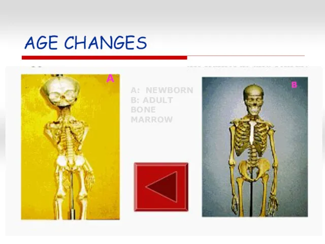 AGE CHANGES A: NEWBORN B: ADULT BONE MARROW A B