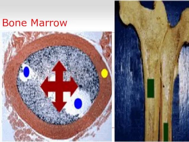 Bone Marrow