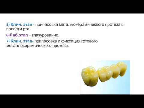 5) Клин. этап - припасовка металлокерамического протеза в полости рта.