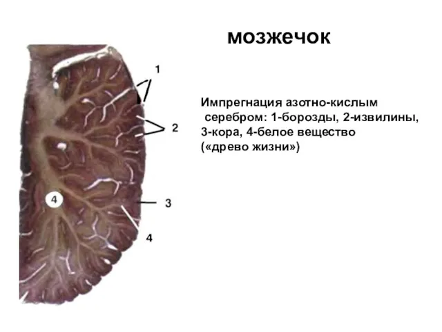 мозжечок Импрегнация азотно-кислым серебром: 1-борозды, 2-извилины, 3-кора, 4-белое вещество («древо жизни»)
