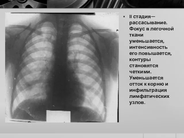 II стадия—рассасывание. Фокус в легочной ткани уменьшается, интенсивность его повышается,