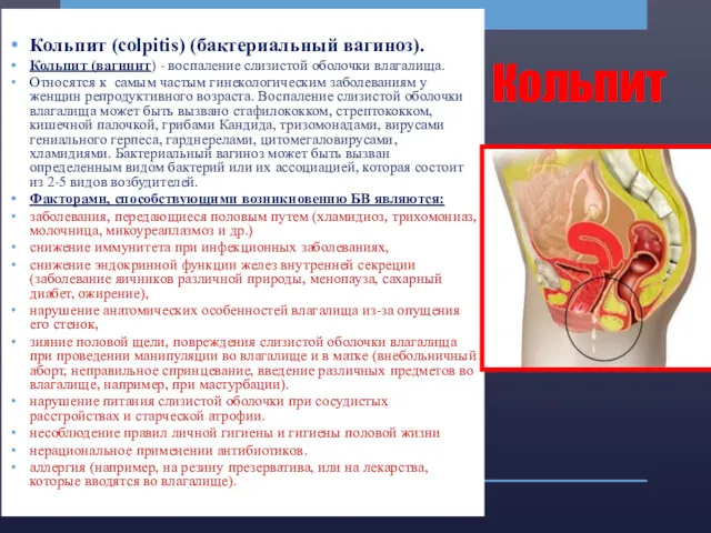 Кольпит Кольпит (colpitis) (бактериальный вагиноз). Кольпит (вагинит) - воспаление слизистой