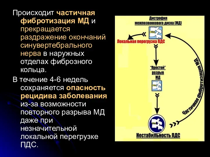 Происходит частичная фибротизация МД и прекращается раздражение окончаний синувертебрального нерва