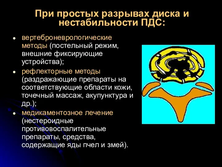 При простых разрывах диска и нестабильности ПДС: вертеброневрологические методы (постельный