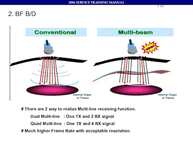 2. BF B/D # There are 2 way to realize