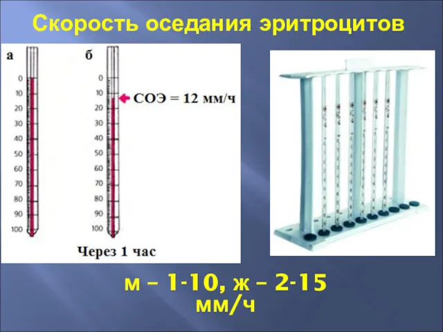 Скорость оседания эритроцитов м – 1-10, ж – 2-15 мм/ч