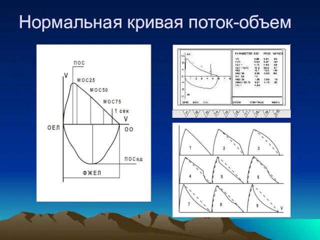 Нормальная кривая поток-объем