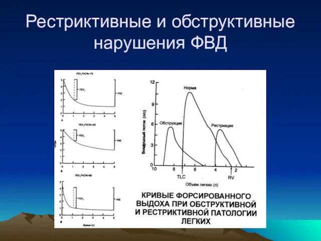 Рестриктивные и обструктивные нарушения ФВД