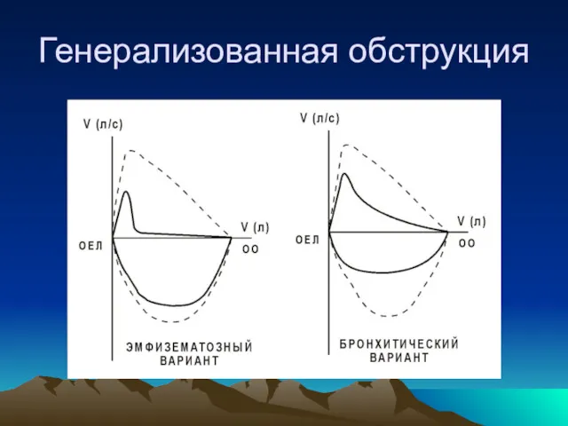 Генерализованная обструкция