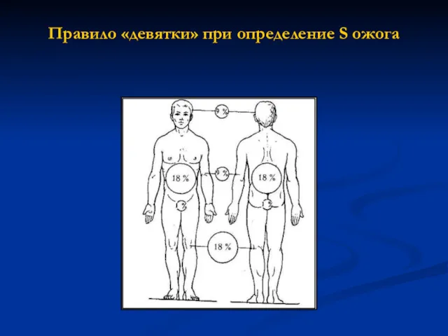 Правило «девятки» при определение S ожога