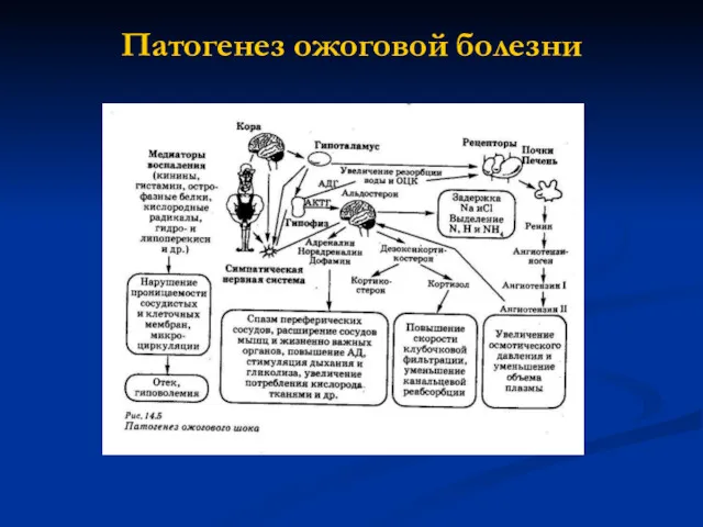 Патогенез ожоговой болезни