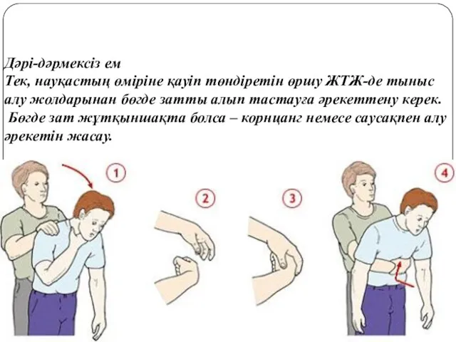 Дəрі-дəрмексіз ем Тек, науқастың өміріне қауіп төндіретін өршу ЖТЖ-де тыныс