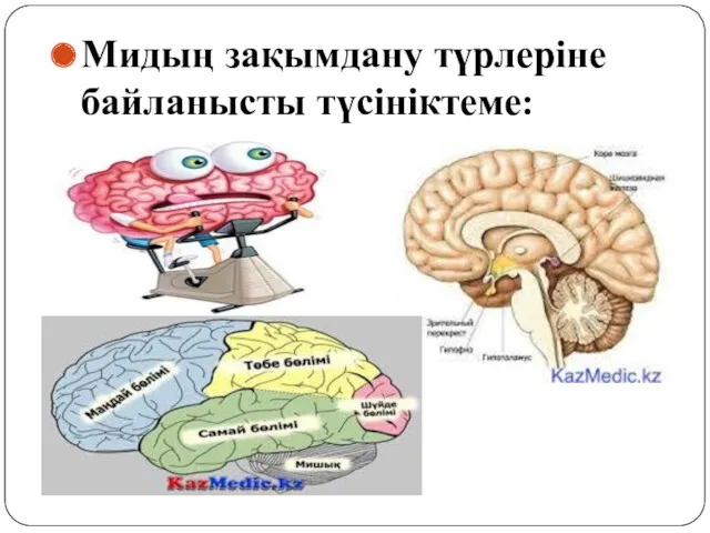 Мидың зақымдану түрлеріне байланысты түсініктеме: