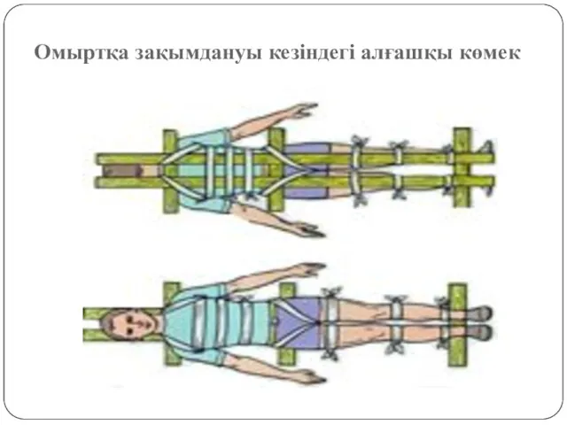 Омыртқа зақымдануы кезіндегі алғашқы көмек