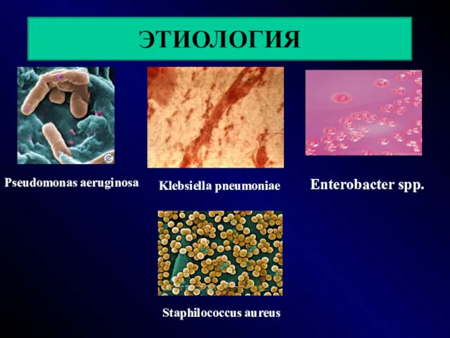 ЭТИОЛОГИЯ Pseudomonas aeruginosa Klebsiella pneumoniae Enterobacter spp. Staphilococcus aureus